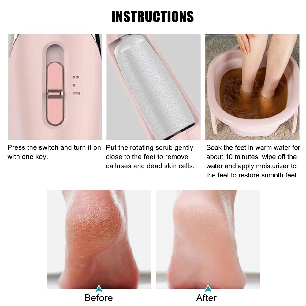 Electric Foot Sharpener | Pedicure Callus Remover & Dead Skin Cleaner