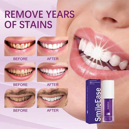 HISMILE V34 Purple Teeth Whitening Toothpaste | Smoke Stain Removal
