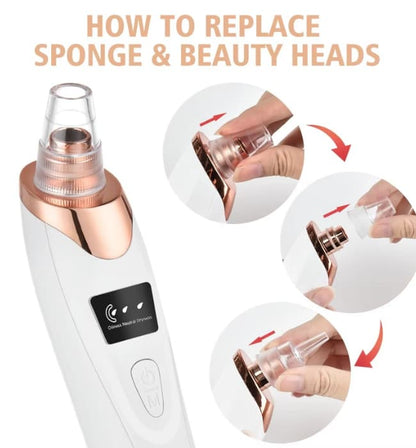 Derma Suction Blackhead Remover & Pore Vacuum Cleaner